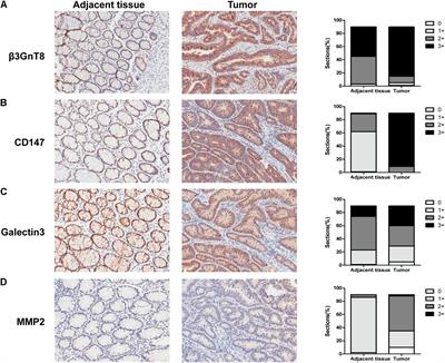 β3GnT8 Promotes Colorectal Cancer Cells Invasion via CD147/MMP2/Galectin3 Axis